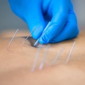Pijnbestrijding zonder medicatie voor sporters en actieve mensen